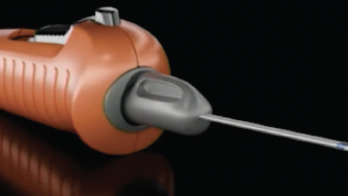 Allograft Placement Using the CycloPen System