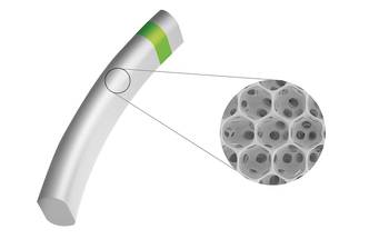 iSTAR Medical Present Final Results From STAR-II European Trial for MINIject in Glaucoma Patients at AAO image