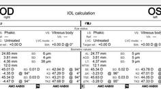 High Astigmatism With Underlying Ectasia