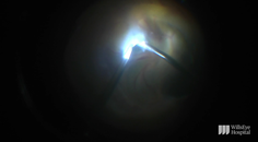 Surgery for an Infant With Stage5 Familial Exudative Vitreoretinopathy thumbnail
