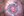Figure 9. A CTR was inserted after enlargement of the CCC.