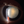 Figure 2. Slit-lamp photograph of an intumescent cataract in the right eye.