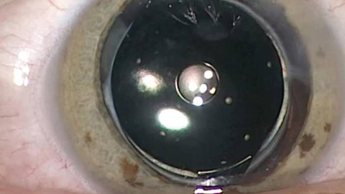 Small Aperture Optics An Old Principle Made New
