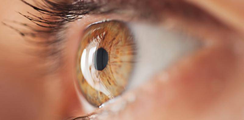 How Should I Manage the 10 Year Post LASIK Patient Who is Now Unhappy With His or Her Vision