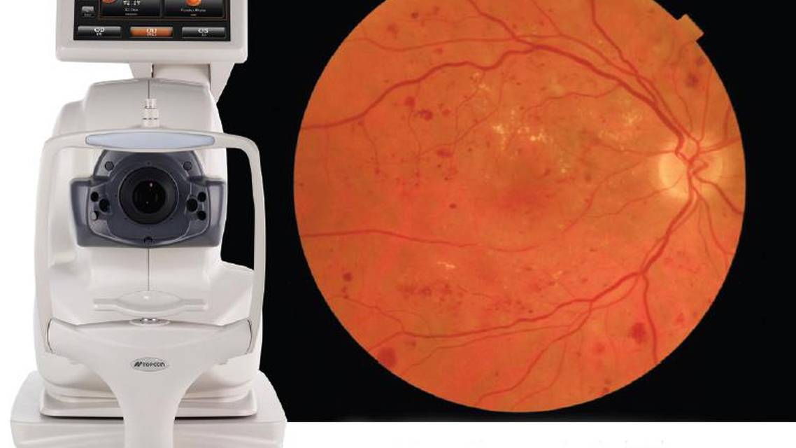 Octus System The Next-Generation Automated OCT and Fundus Imaging S...