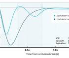 Surgical efficiency and ocular health with cataract surgery at a near physiologic IOP