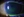 Figure 1. Macrostriae and a large inferior gutter in the left eye.
