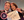 Figure 24. Dr. Shamie with J. Morgan Micheletti, MD.