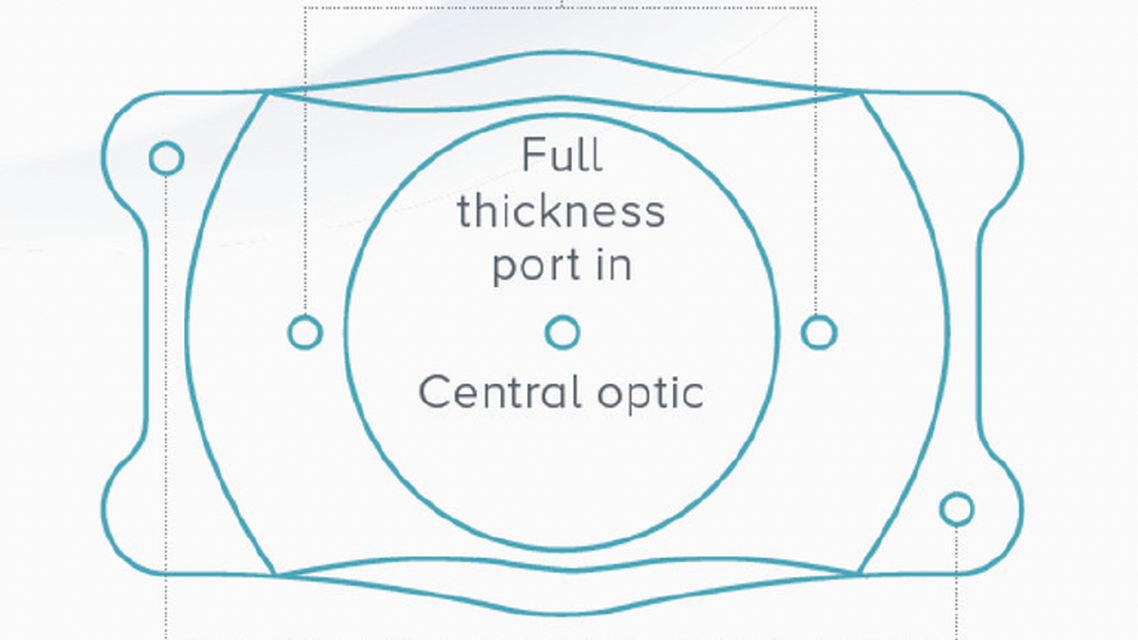 Mastering the Preoperative Exam