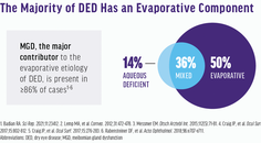 A Paradigm Shift in Evaporative Dry Eye Disease Management
