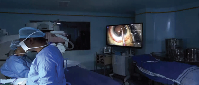 Integrated Cataract Workflow In My OR