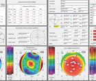 Unreadable Keratometry