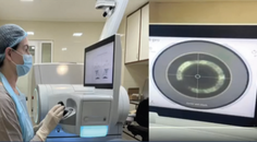 ZEISS VISUMAX 800 Redefining Refractive Surgery with Unmatched Speed and Comfort