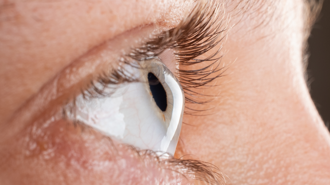 Improving Refractive Outcomes in Keratoconic Eye