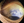 Figure 2. Conjunctival and episcleral pigmentation in the left eye.