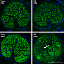 New UCI-led Study Shows Repeated Stress Accelerates Aging of the Eye image