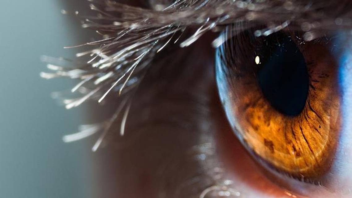 Intermittent Pain and Corneal Scarring