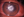 Figure. A central ring-shaped anterior to midstromal infiltrate with feathery margins and surrounding satellite lesions (arrow).