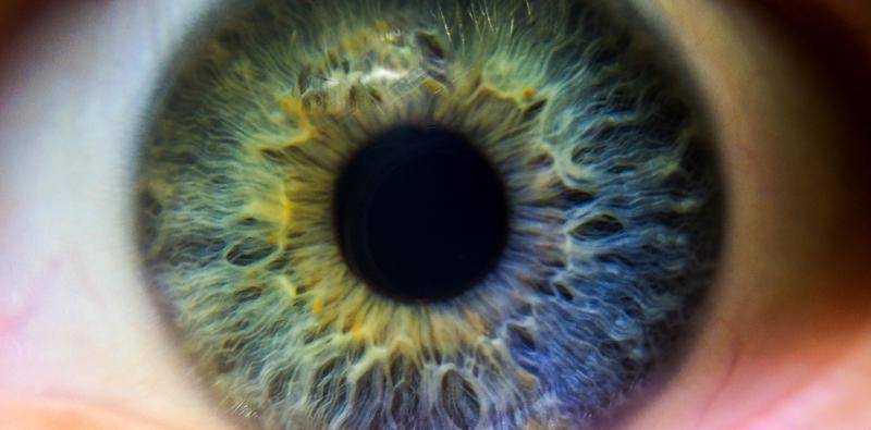 A Custom Iris Prosthesis Finally Gains FDA Approval