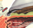 2024 Glaucoma Pipeline