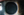 Figure 1. Slit-lamp photograph of PXF material on the anterior lens capsule.