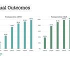 Advancements in Monofocal IOL Technology