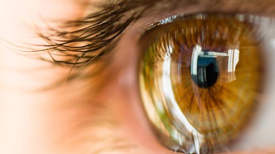 Initial Results With Allograft Corneal Inlays