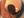 Figure 4. The eye 3 months after surgery.
