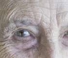 A Noninvasive Alternative to Cataract Surgery