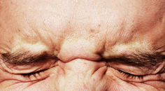 Managing the Unhappy Refractive Cataract Patient