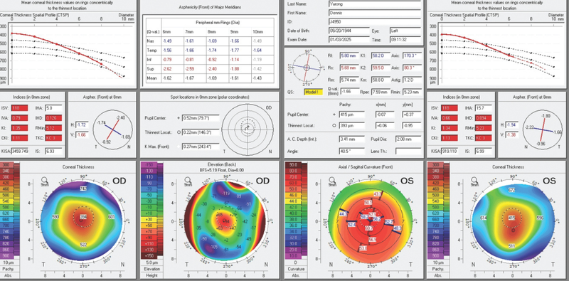 Unreadable Keratometry