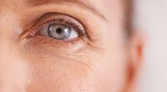 Pressure Induced Stromal Keratitis