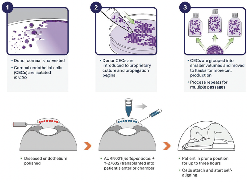 Corneal Endothelial Cell Therapy
