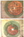 Figure 2. Intraoperative laser cataract surgery image
showing defragmentation and quadrant creation (top).
It is helpful to show images like these to patients
to explain the laser’s role. Another example of the
femtosecond laser performing fragmentation of the
nucleus (bottom).