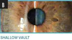 What You Can Expect With Patient Outcomes