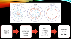Corneal Considerations for Refractive Surgery Procedures