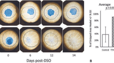 New Horizons in Corneal Endothelial Therapy