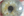Figure 1. A relatively small pupil defect caused by iris aspiration.