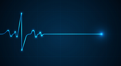 Case Study When the Heart Skips a Beat