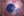 Figure 5. The anterior capsule was stained with trypan
blue dye to improve visualization.