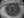 Figure 1. Markerless reference image with CALLISTO eye to aid in toric IOL alignment. Image courtesy of Richard S. Davidson, MD.