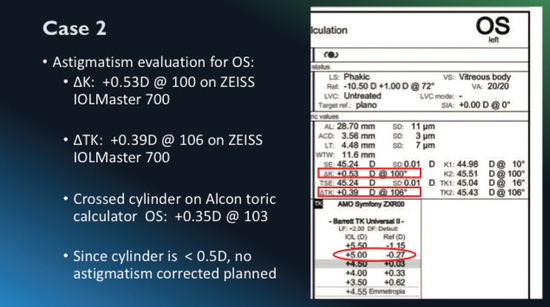 Best Practices in IOL Calculations