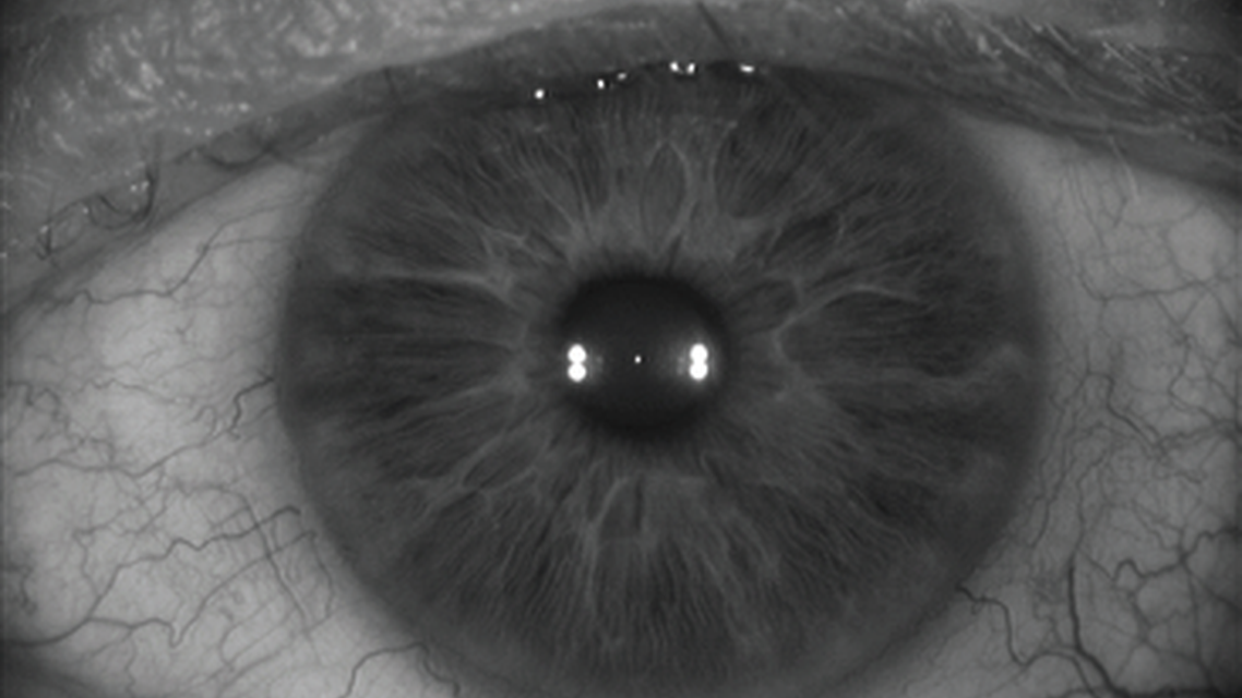 The Current Cataract Refractive Landscape