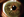 Figure 12. Postoperative slit-lamp photograph.