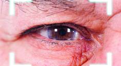 Secondary IOL Implantation After Complicated Primary Surgery
