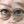 Figure 1. Appearance of the eye before IPL treatment and ThermiEyes (ThermiGen) radiofrequency treatment (A). Appearance of the eye 1 month later, after two IPL and ThermiEyes treatments (B).