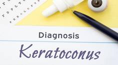 I Underwent CXL to Treat My Keratoconus