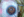 Figure 3. Hydrodissection is performed so that the nucleus
can freely rotate.