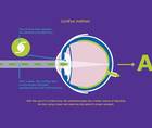 Making Room for Future IOL Technologies