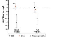 Formulation Matters New Data Demonstrates Qlosi is Pupil Selective